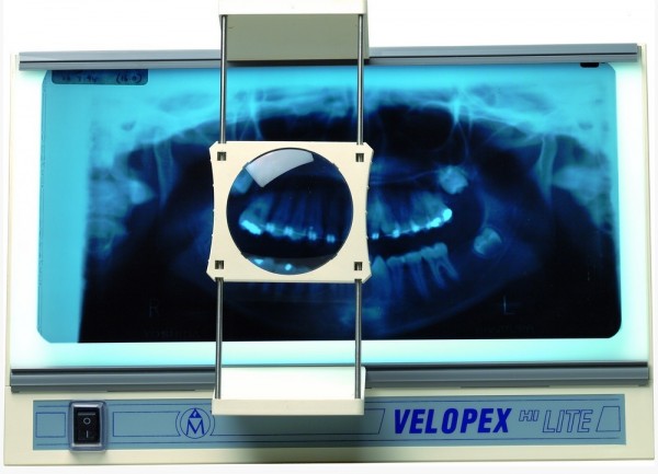 Velopex_Hi-Lite_X-Ray_Film_Viewer_with_Magnifier.jpg